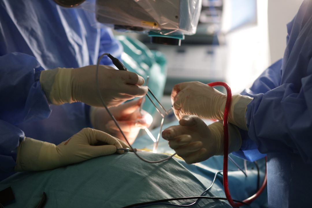 Litiaza biliară: De ce scoaterea colecistului este singura soluție sigură în cazul pietrelor