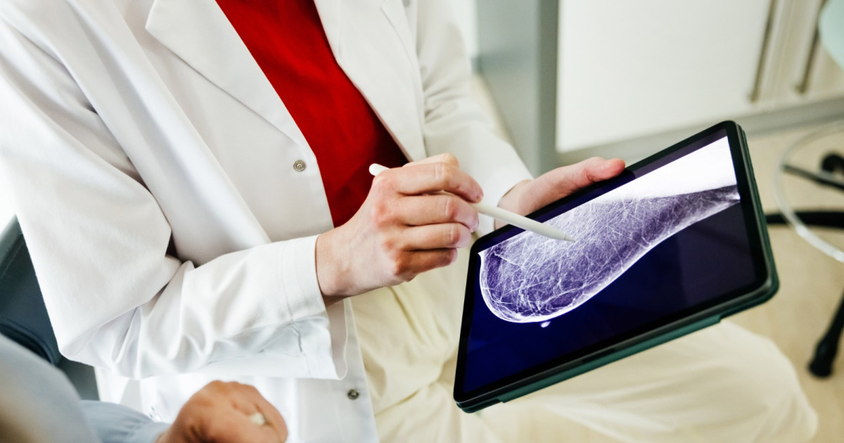 Un medicament pentru oprirea lactației ar putea reduce cu 69% riscul de cancer de sân