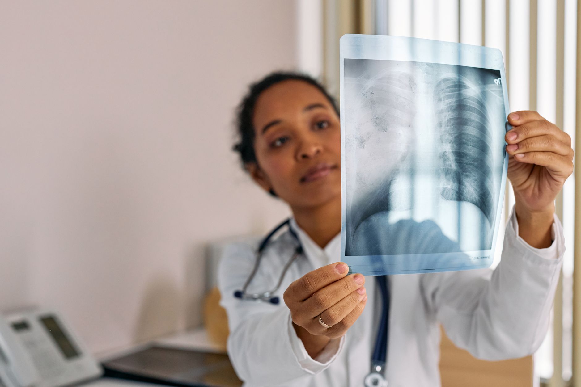 Cancerul pulmonar poate fi detectat fără simptome: cine trebuie să facă CT anual