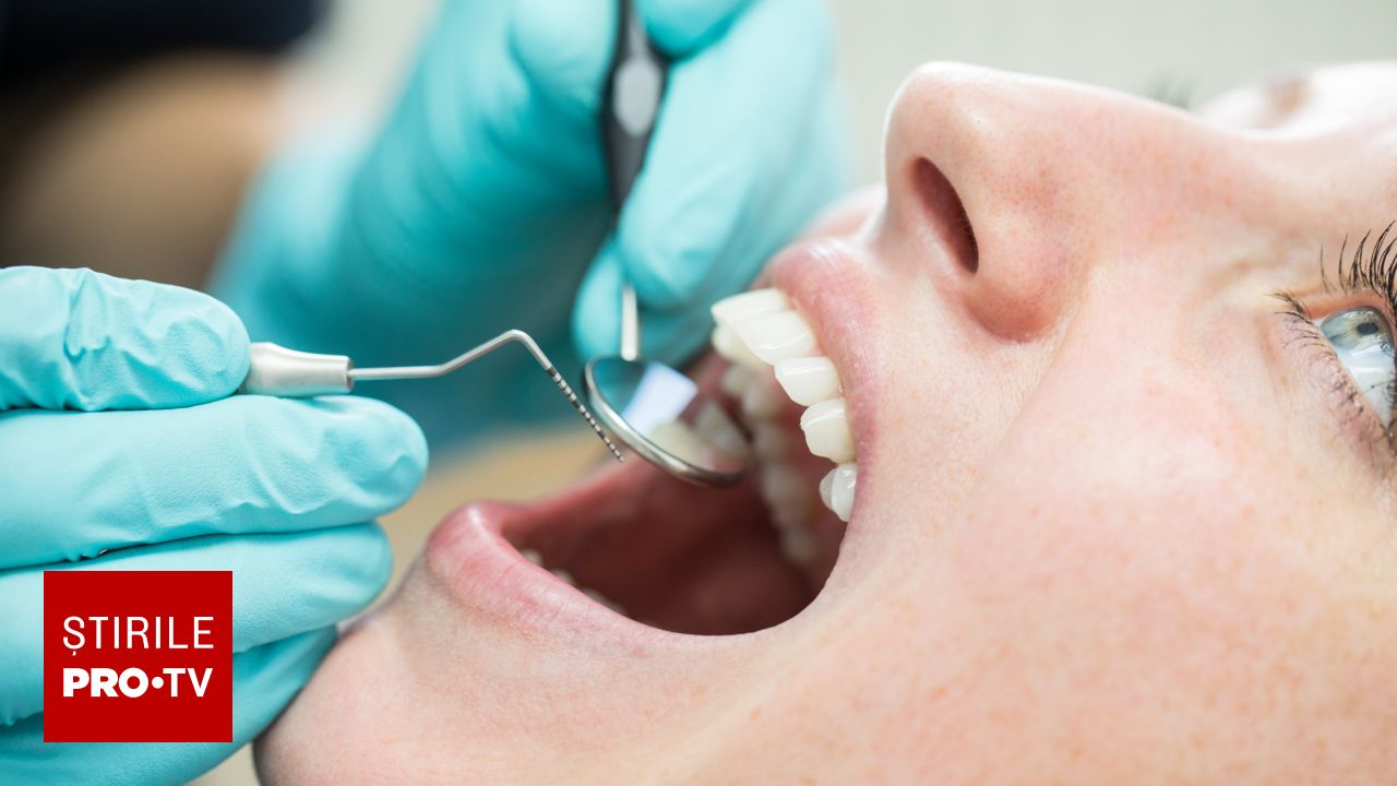 Importanța igienizării dentare la fiecare șase luni și limitările procesului de albire