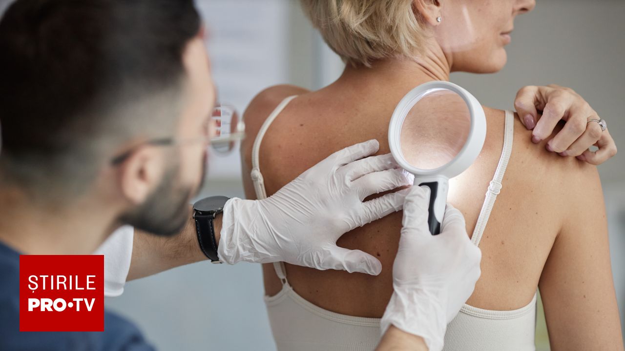 Un nou vaccin personalizat reduce cu 42% riscul de deces în cazul melanomului