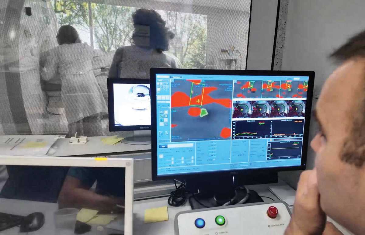 Tehnologie care elimină tremorul fără bisturiu: cum funcționează procedura Exablate Neuro