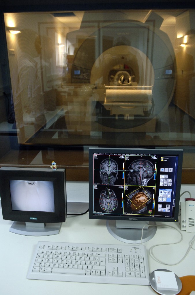 Peste 288.000 de români suferează de demență, majoritatea fiind femei cu Alzheimer