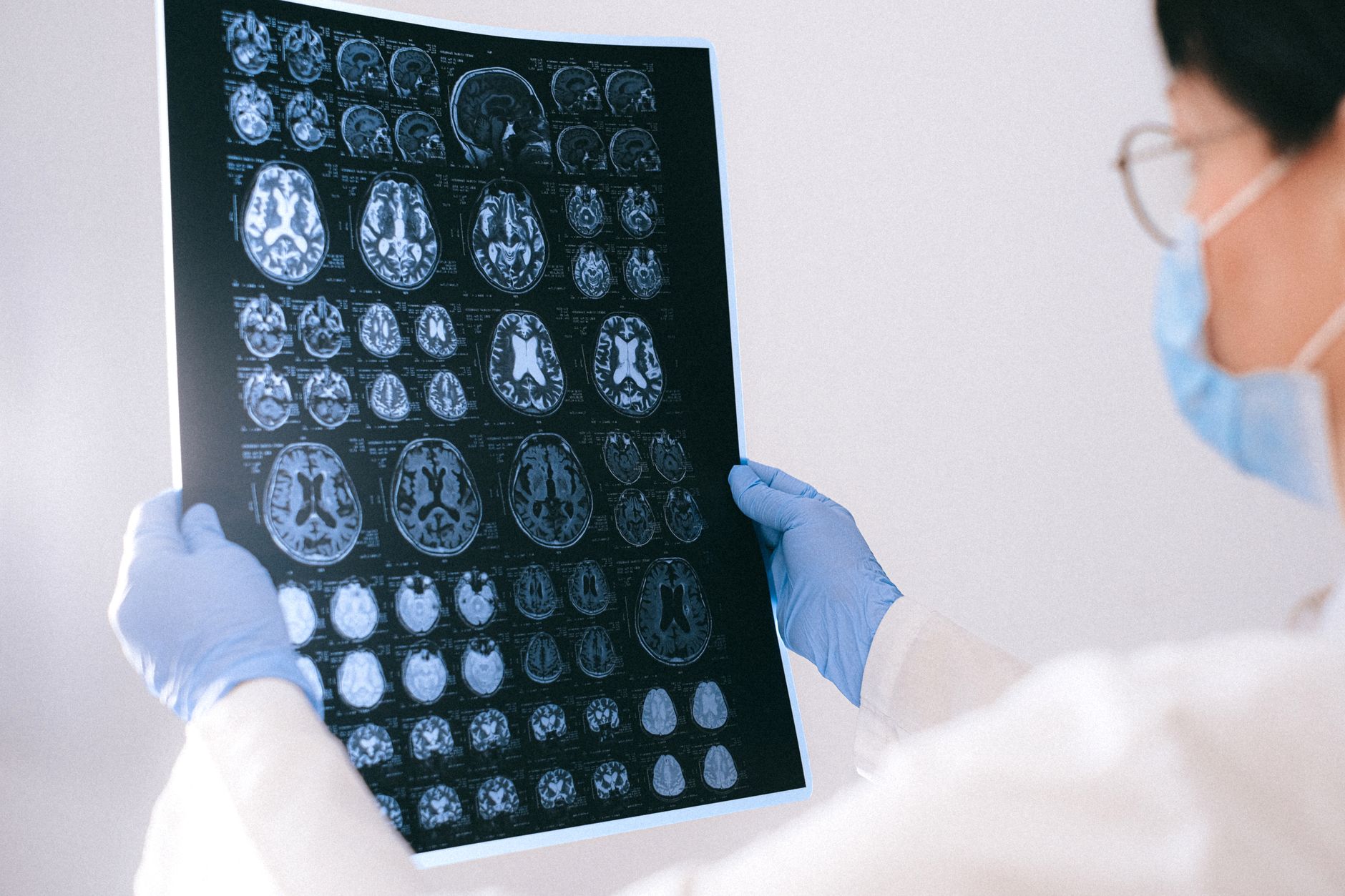 România se confruntă cu un val de demență: Parteneriat nou pentru diagnosticarea timpurie a bolii Alzheimer