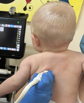 Inteligența artificială în ecografia pulmonară pediatrică: rolul medicului rămâne esențial