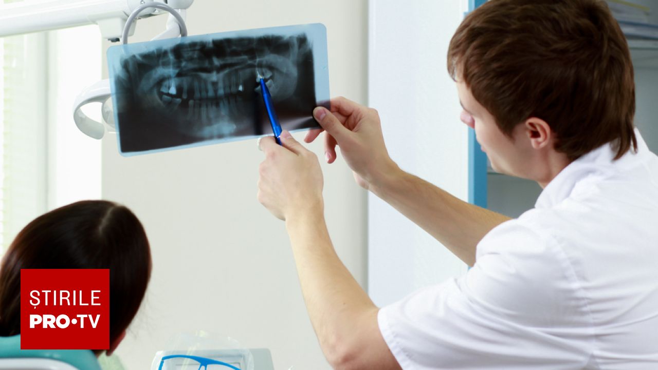 Efectul pierderii unui singur dinte asupra maxilarului și necesitatea adiției osoase înainte de implant