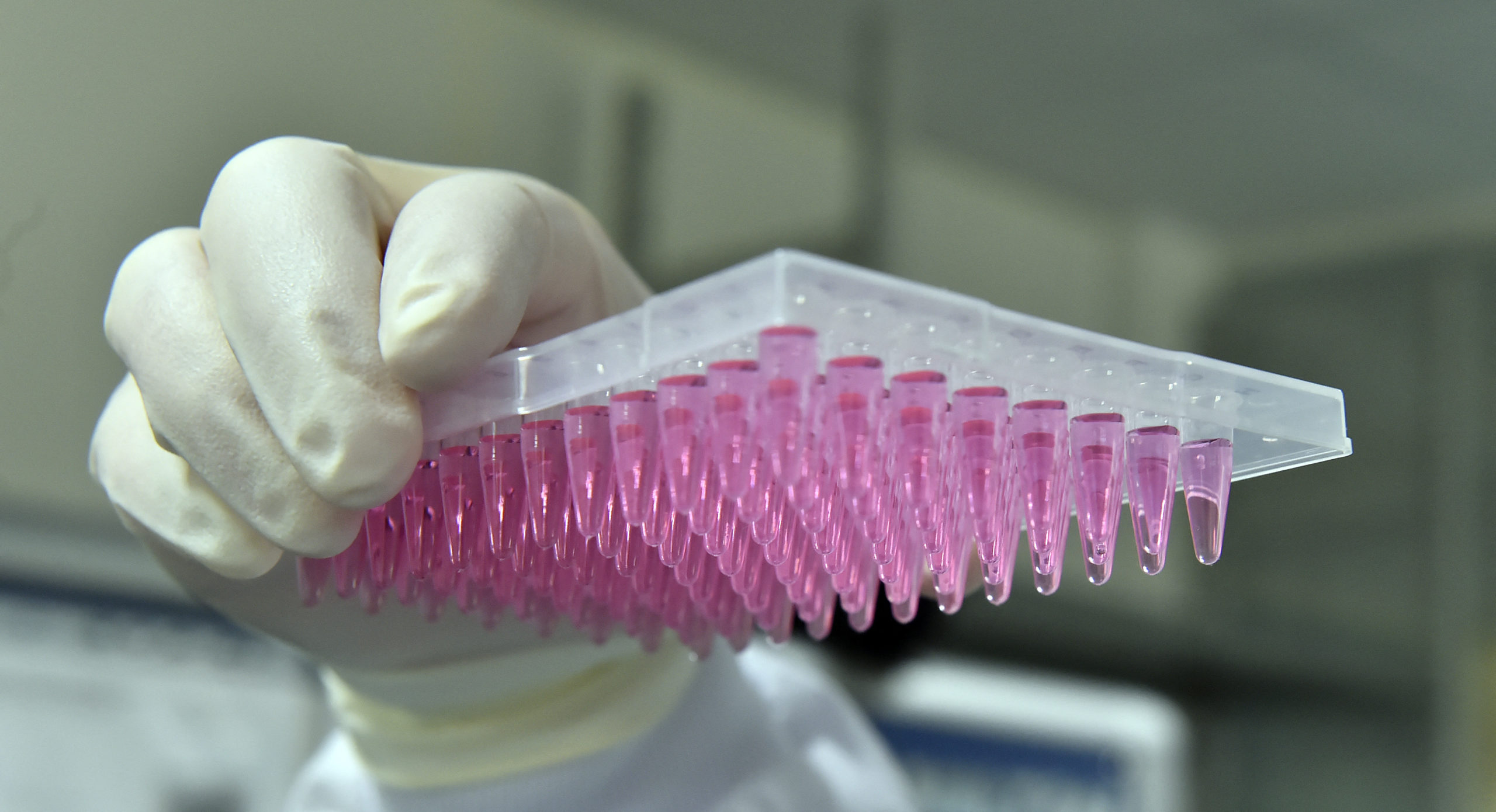 Marea Britanie testează un test genomic rapid pentru diagnosticarea tumorilor cerebrale