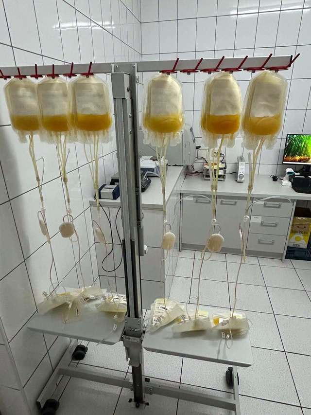 Centrul de Transfuzie Sanguină București introduce în premieră un nou component sanguin: amestec de concentrate trombocitare