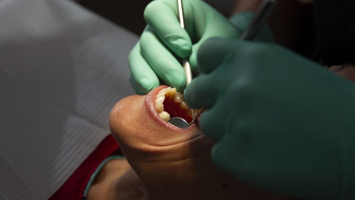 Atenție la simptomele din gură: cum o simplă radiografie dentară poate salva viața de la cancer