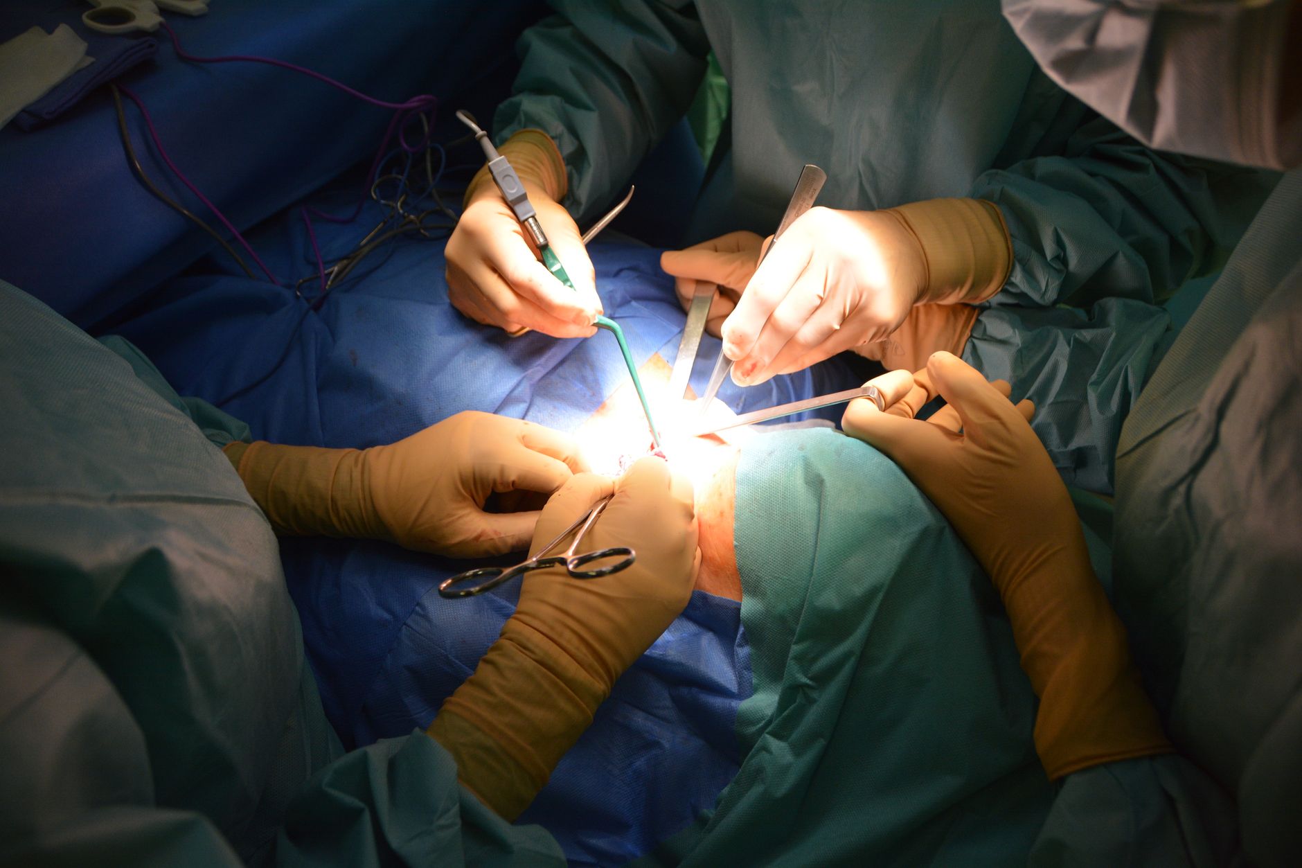 Procedură cardiacă rară la MedLife Sibiu: intervenție TAVI pe un pacient cu anatomie în oglindă