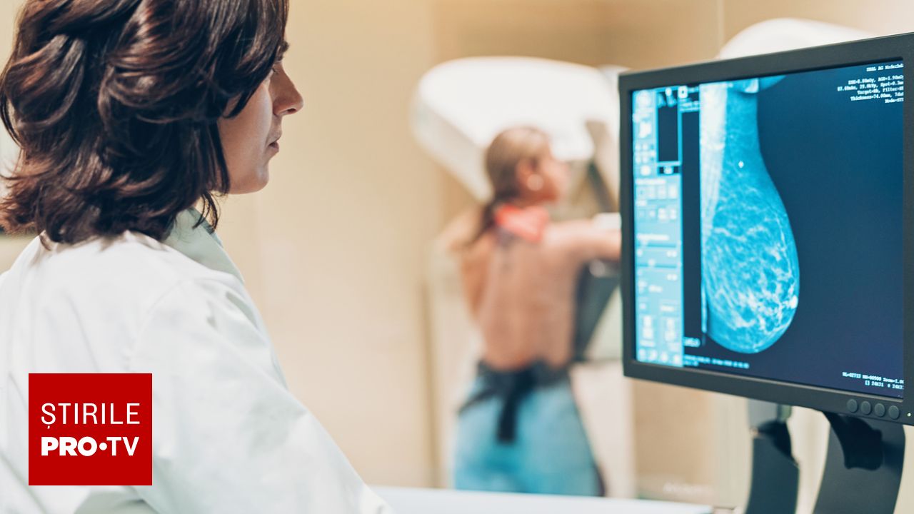 Cancerul de sân poate apărea chiar și la 20 de ani, avertizează medicii. Importanța controalelor periodice