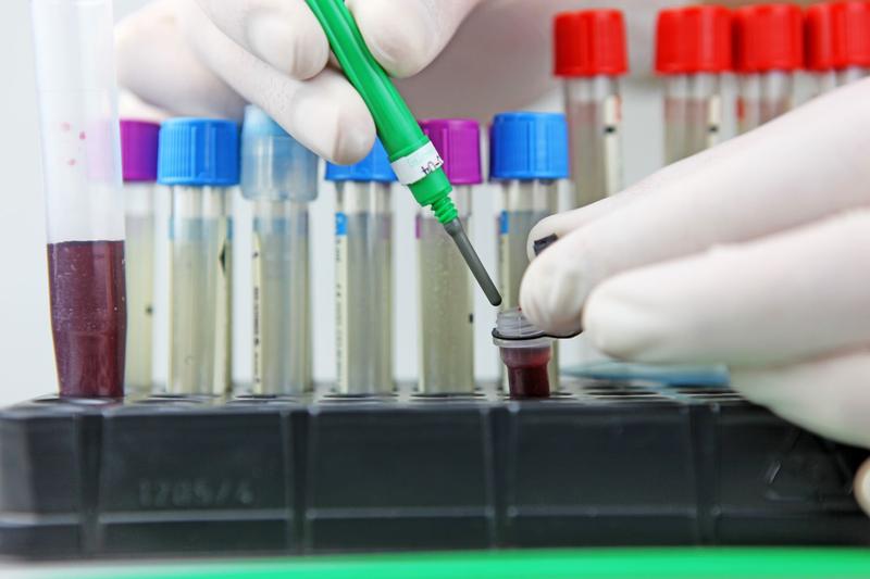 A fost identificată o tulpină de Candidozyma auris rezistentă la patru clase de antifungice în Kenya