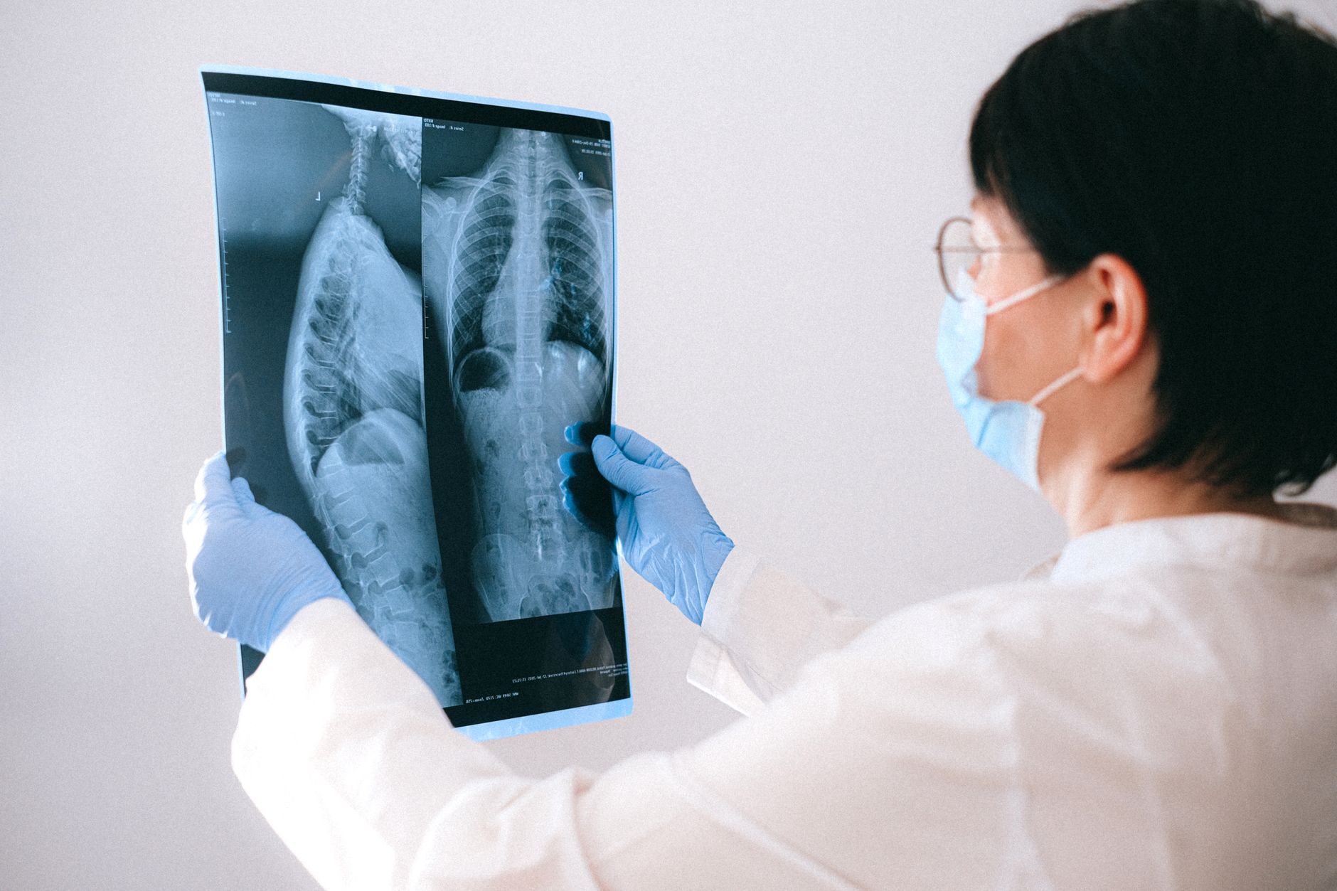 Investigația PET-CT PSMA: Cum poate ajuta monitorizarea extinderii cancerului de prostată