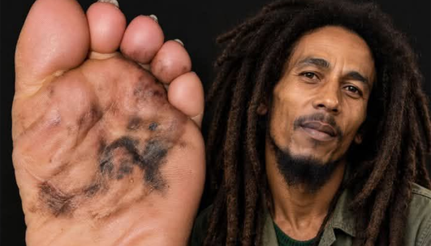 Povestea tragică din spatele morții lui Bob Marley: cum un deget de la picior a dus la sfârșitul muzicianului