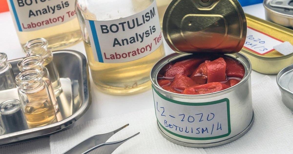 Suspiciune de botulism în Vaslui: bărbat de 46 de ani este internat după ce a consumat conserve de pește