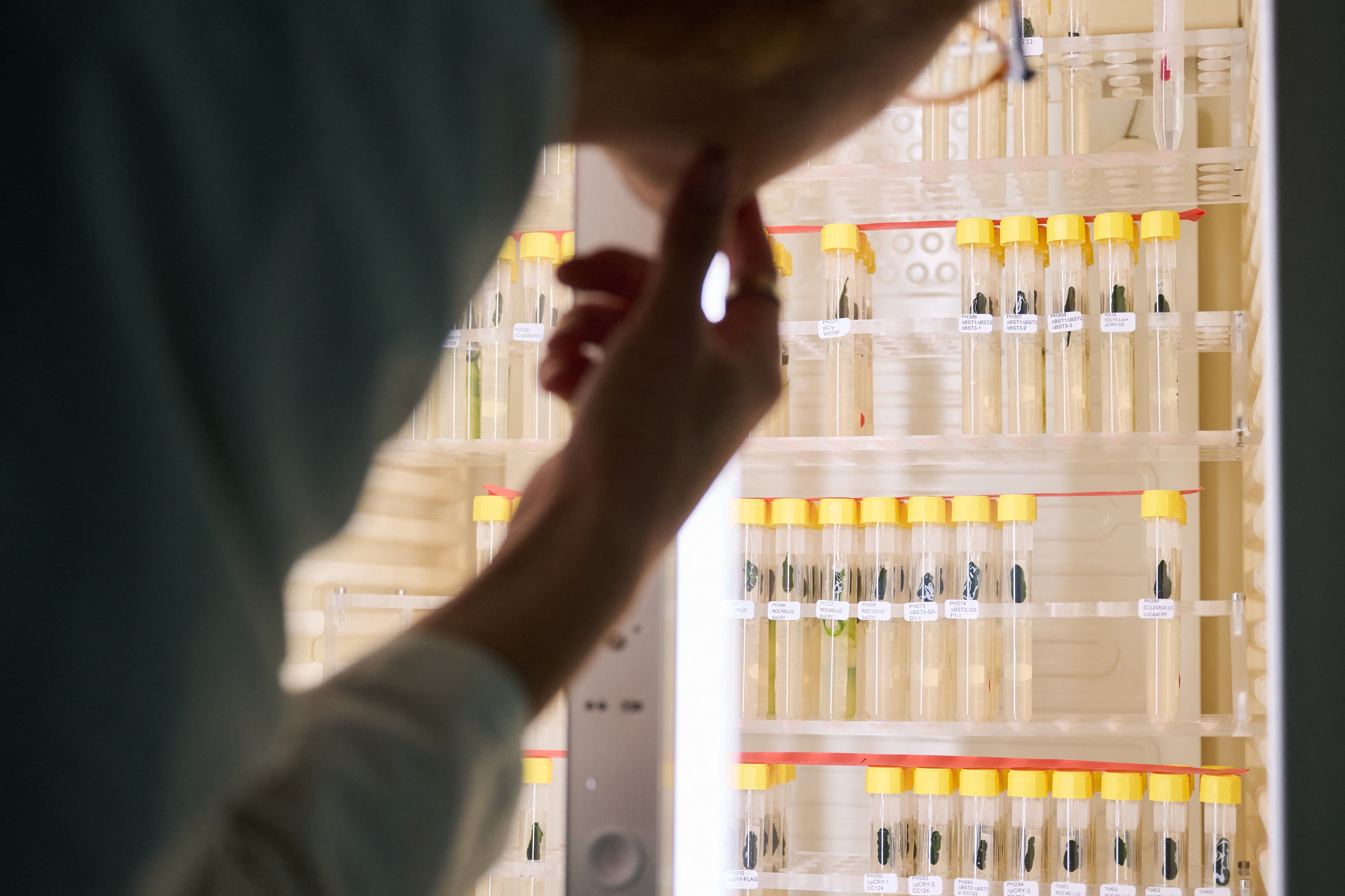 Tehnologia optogeneticii, premiată cu Nobel, poate revoluționa tratarea bolilor neurologice