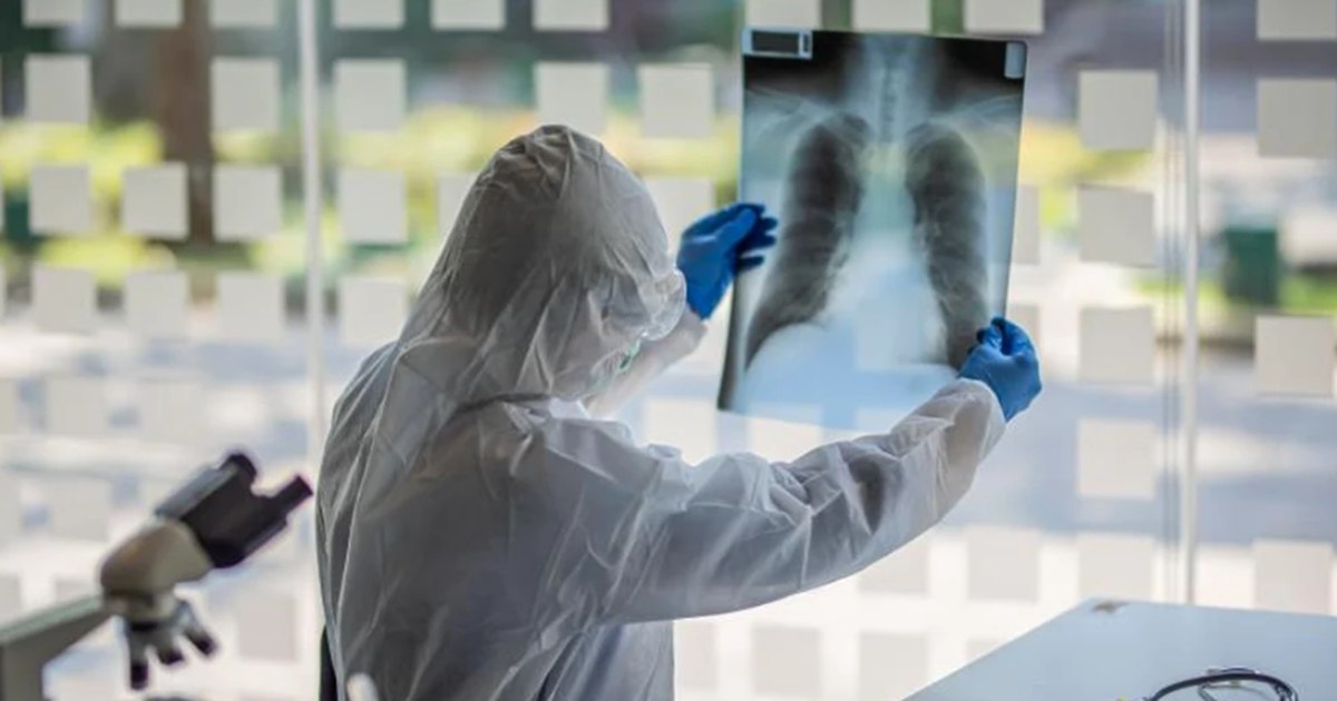 Ce este un nodul pulmonar și de ce este monitorizat de către medici în cazul Papei Leon al XIV-lea