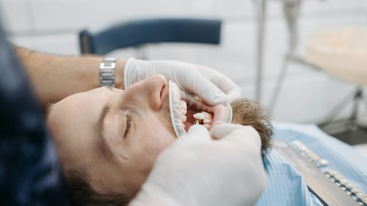 Absența dinților permanenți la tineri: când este indicat un implant dentar după pierderea dinților de lapte